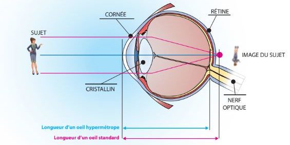 visuelle désignant l’ensemble des symptômes de fatigues oculaires. Caractérisée par un inconfort visuel et un dysfonctionnement musculaire l'asthénopie se traduit par des maux de tête, une perte de concentration, une fatigue anormale et une potentielle baisse de vue pouvant être floue. Les symptômes peuvent être temporaires ou permanents. 